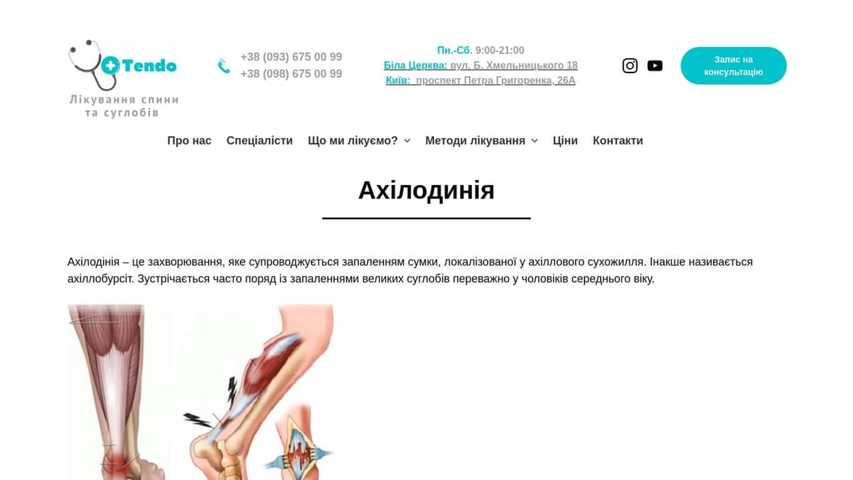 Ахілодинія