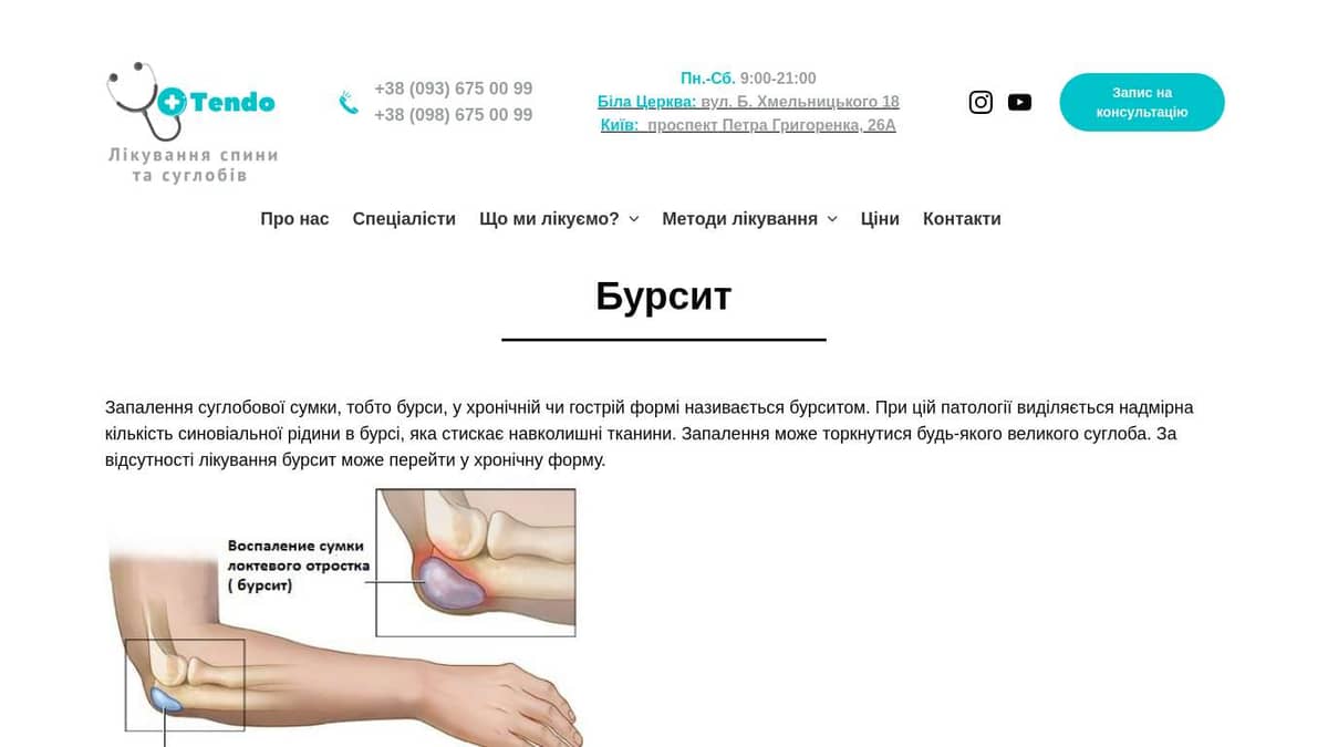 Лечение неинфекционного бурсита