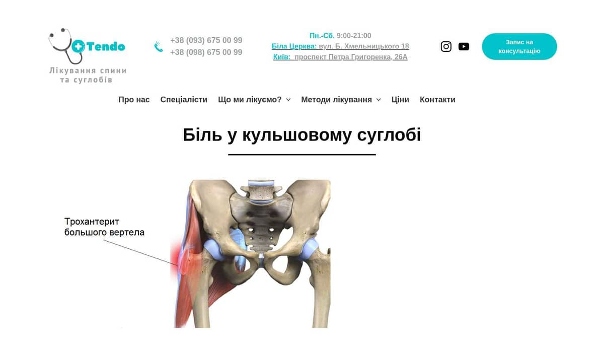 Біль у кульшовому суглобі