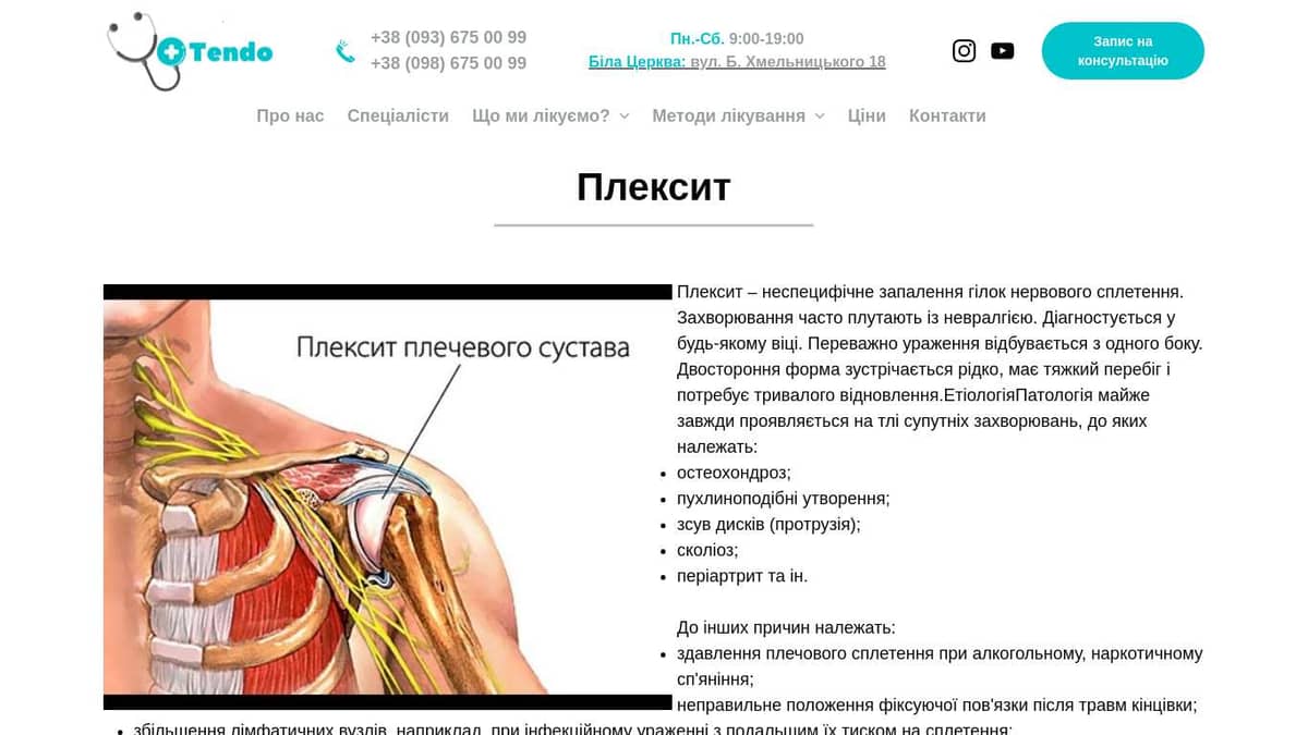 Плексит